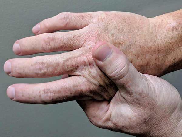 How Chiropractic Care Helps Arthritis: Pain Relief, Mobility, and Better Joint Health