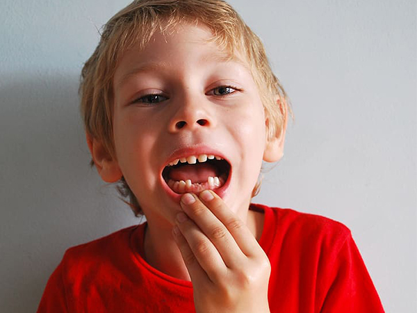 What Happens If a Baby Tooth Has a Cavity? Why Early Treatment Matters
