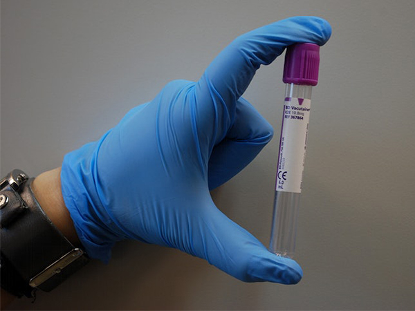 What Blood Tests Reveal About Your Health: A Complete Guide to Common Lab Work