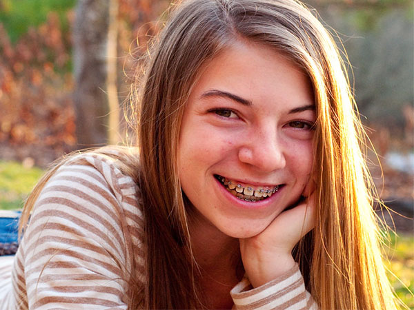 Essential Tips for Maintaining Oral Health with Braces