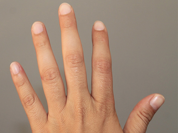 Say Goodbye to Brittle Nails: Essential Tips for Strong and Healthy Nails