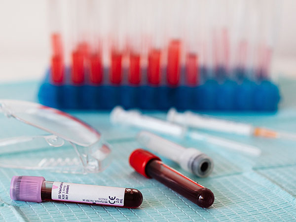 How Often Should You Check Your Cholesterol? A Practical Guide for Heart‑Healthy Living