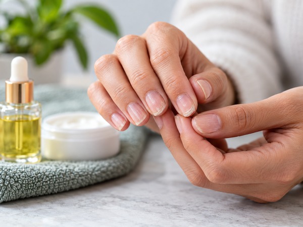 7 Signs Your Fingernails Are Too Dry and What You Can Do About It