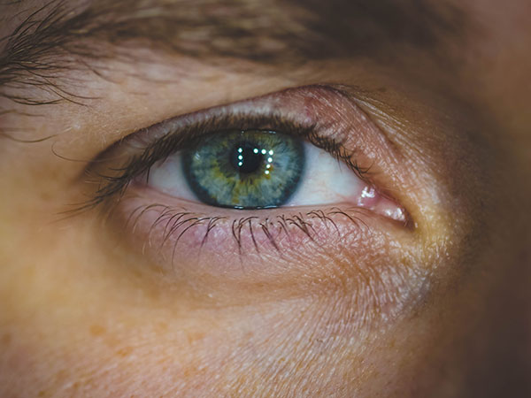 Why Is My Eye Twitching? Common Causes and Simple Ways to Find Relief