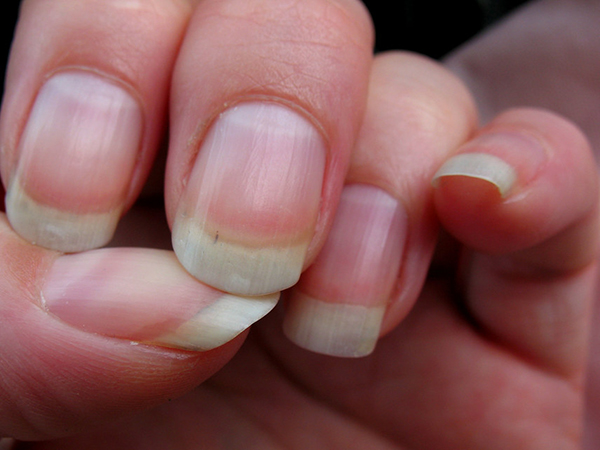 What Fingernail Color Says About Your Health and Personality: A Complete Guide