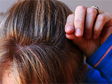 How to Prevent Dry Scalp and Dandruff
