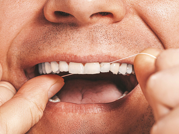 How to Prevent Gum Disease: Essential Tips for Healthy Gums and Strong Teeth