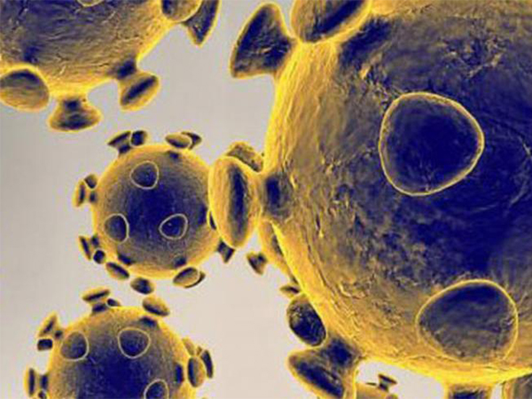 9 Effective Ways to Kill Germs at Home and Create a Healthier Living Space