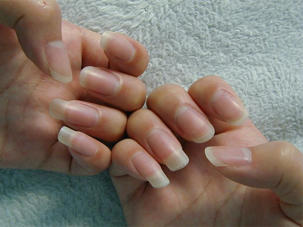 10 Proven Tips for Faster Nail Growth and Stronger, Healthier Nails
