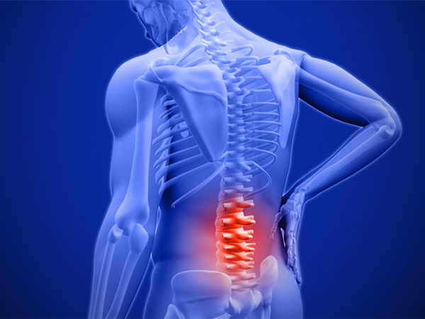 Holistic Approaches to Manage Sciatica Pain
