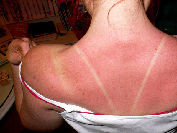 How to Reverse Sun Damage and Restore Healthy, Radiant Skin