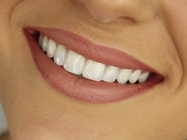 Achieve a Brighter Smile: Tooth-Whitening Options Explained