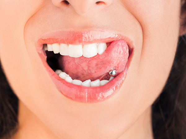 Tongue Piercings and Oral Health: Risks to Teeth, Gums, and How to Protect Your Smile