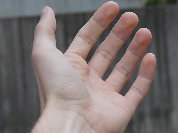 Why Are My Hands Shaking? Common Causes of Hand Tremors and When to Seek Help