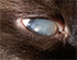 When Cloudy Eye Could Mean More Than Aging