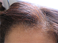 Itchy Scalp Causes And Treatment Tips